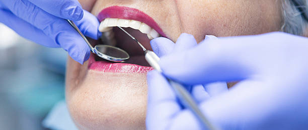Best Emergency Dentist for Lost Fillings or Crowns in St Ann, MO